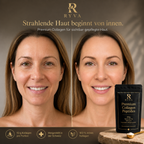 RYVA Premium Collagen Peptides | 300 g = 30 Portionen